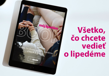 Všetko, čo ste chceli vedieť o lipedéme – stiahnite si e-book!