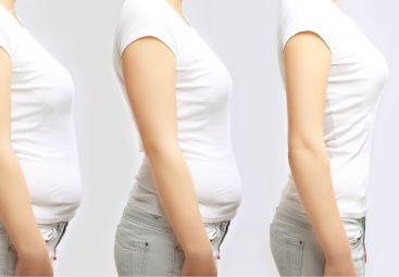 Trendy v plastickej chirurgii 2026: vplyv liekov na chudnutie